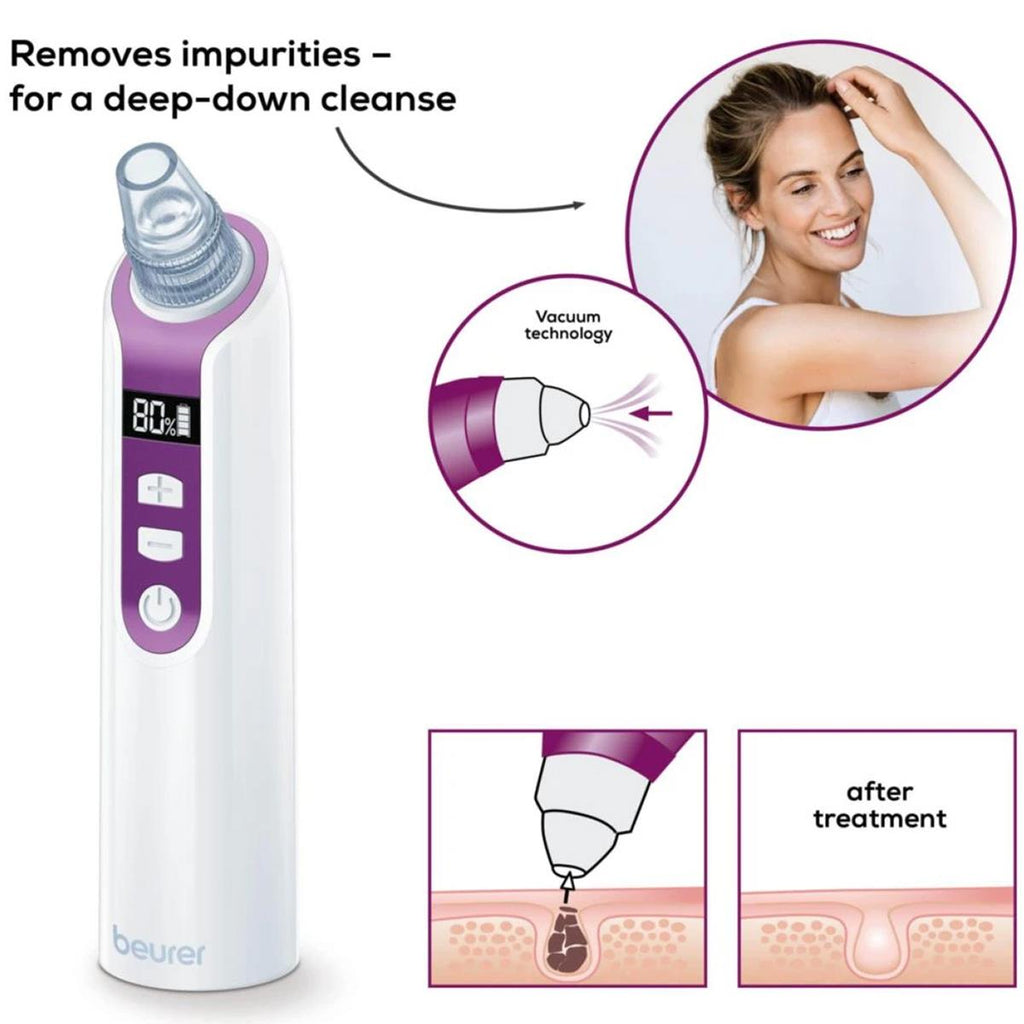Beurer Deep Pore Cleaner And Vacuum Blackhead Removal - Purple/White