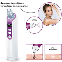 Beurer Deep Pore Cleaner And Vacuum Blackhead Removal - Purple/White