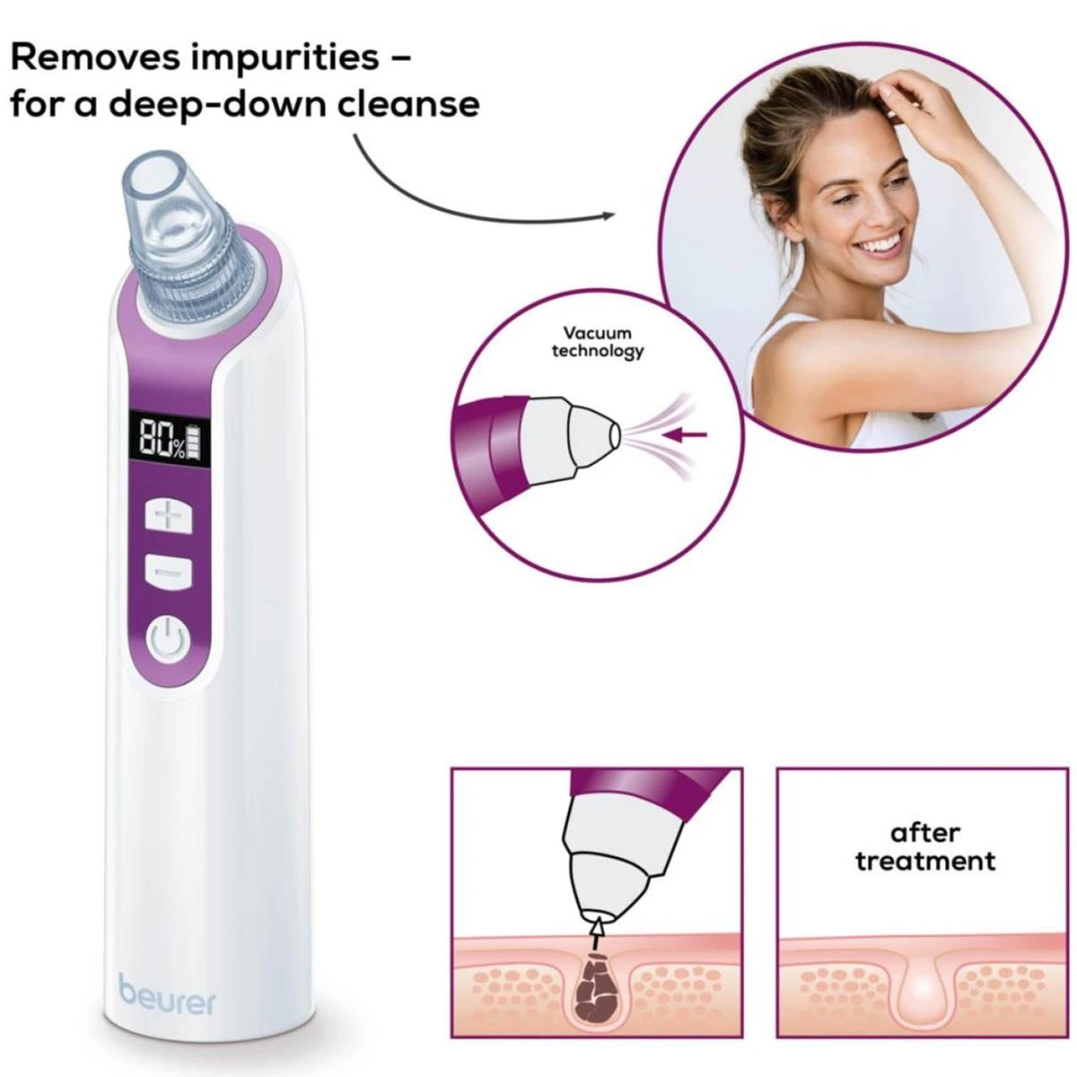 Beurer Pore Cleaner Facial Blackhead Remover With Vacuum Technology 3 Attachments 5 Intensity Levels LCD Display Purple - Image 4